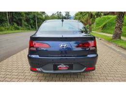HYUNDAI - HB20S - 2020/2021 - Azul - R$ 77.500,00